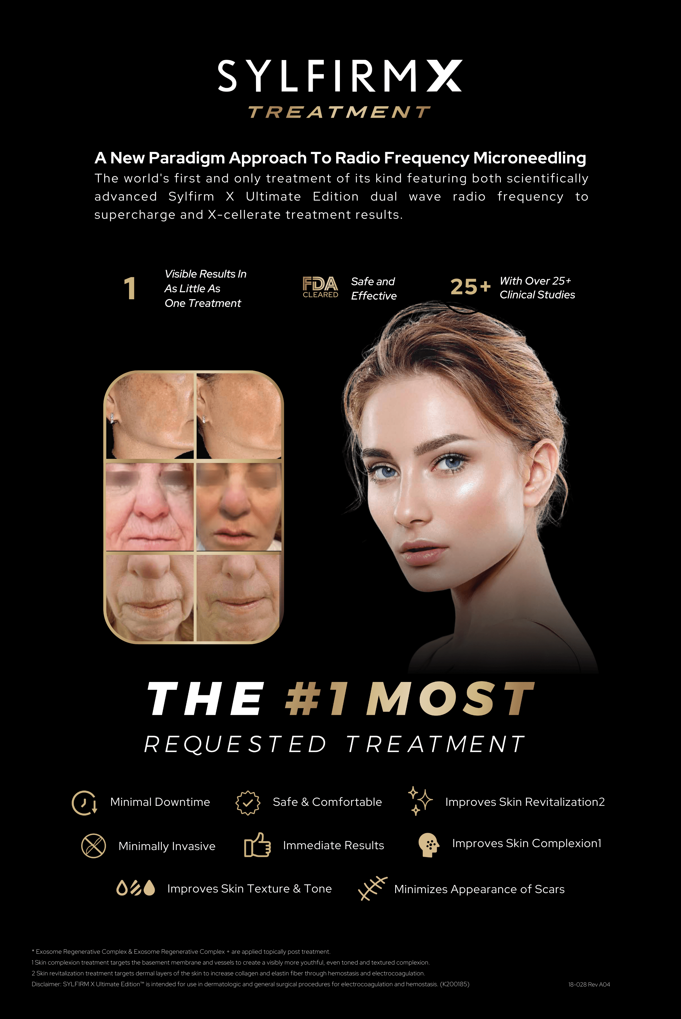 Premium RF Microneedling, SylfirmX